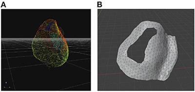 Development of a 3D printed surgical guide for Brugada syndrome substrate ablation